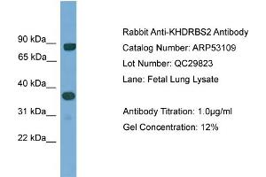 WB Suggested Anti-KHDRBS2  Antibody Titration: 0.