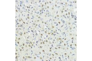 Immunohistochemistry of paraffin-embedded rat ovary using Phospho-Histone H3-T32 antibody (ABIN7267691) at dilution of 1:100 (40x lens).