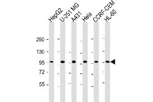 All lanes : Anti-TAF4 Antibody (C-Term) at 1:2000 dilution Lane 1: HepG2 whole cell lysate Lane 2: U-251 MG whole cell lysate Lane 3: A431 whole cell lysate Lane 4: Hela whole cell lysate Lane 5: CCRF-CEM whole cell lysate Lane 6: HL-60 whole cell lysate Lysates/proteins at 20 μg per lane.