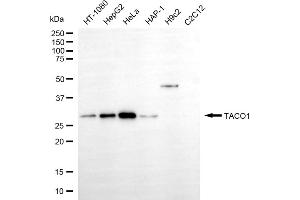 Western blotting analysis using TACO1 antibody (ABIN7798114).