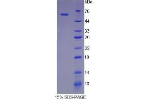 SDS-PAGE (SDS) image for Ribophorin 1 (RPN1) (AA 273-518) protein (His tag,GST tag) (ABIN1878288)