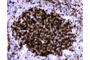 Anti-CD23 Picoband antibody,  IHC(P): Mouse Spleen Tissue