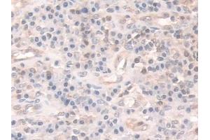 Detection of COTL1 in Human Appendix Tissue using Polyclonal Antibody to Coactosin Like Protein 1 (COTL1)