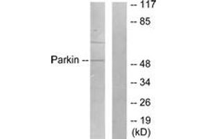 Western blot analysis of extracts from Jurkat cells, using Parkin Antibody. (Parkin anticorps  (AA 1-50))