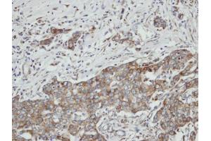 IHC-P Image Immunohistochemical analysis of paraffin-embedded N87 xenograft, using PON2, antibody at 1:100 dilution.