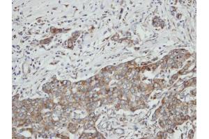 IHC-P Image Immunohistochemical analysis of paraffin-embedded N87 xenograft, using PON2, antibody at 1:100 dilution. (PON2 anticorps)