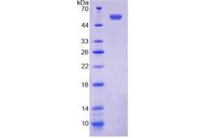 SDS-PAGE of Protein Standard from the Kit (Highly purified E. (TMEM27 Kit ELISA)