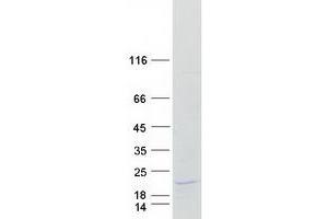 Validation with Western Blot