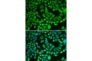 Immunofluorescence analysis of MCF-7 cells using PSMD7 antibody. (PSMD7 anticorps)