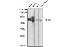 Western blot analysis of extracts of various cell lines, using NDRG1 antibody.