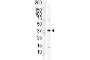 Western Blotting (WB) image for anti-Calcium/calmodulin-Dependent Protein Kinase I (CAMK1) antibody (ABIN3003045)