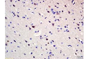Formalin-fixed and paraffin embedded rat brain labeled with Rabbit Anti-Pumilio 1 Polyclonal Antibody, Unconjugated (ABIN1387238) at 1:200 followed by conjugation to the secondary antibody and DAB staining (PUM1 anticorps  (AA 201-300))