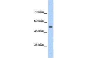 Western Blotting (WB) image for anti-Solute Carrier Family 13 Member 3 (SLC13A3) antibody (ABIN2462409) (SLC13A3 anticorps)