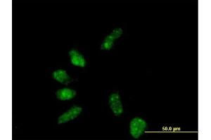 Immunofluorescence of purified MaxPab antibody to GTF2B on HeLa cell. (GTF2B anticorps  (AA 1-316))