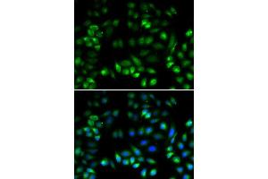 Immunofluorescence analysis of U2OS cells using MANF antibody.