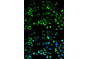 Immunofluorescence analysis of U2OS cells using MANF antibody. (MANF anticorps  (AA 25-182))
