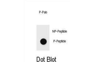 Dot blot analysis of Phospho-BAD-Y76 Antibody Phospho-specific Pab j on nitrocellulose membrane. (BAD anticorps  (pTyr76))