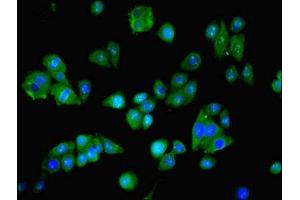 anti-Asparaginyl-tRNA Synthetase (NARS) (AA 1-300) antibody