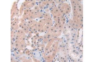 IHC-P analysis of Kidney tissue, with DAB staining. (ACD anticorps  (AA 21-175))
