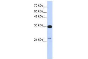 Image no. 1 for anti-TP53 Target 5 (TP53TG5) (AA 143-192) antibody (ABIN6741254) (TP53TG5 anticorps  (AA 143-192))