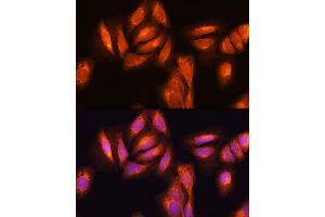 Immunofluorescence analysis of U2OS cells using NF-kB p65/RelA antibody (ABIN6134740, ABIN6146862, ABIN6146864 and ABIN6215109) at dilution of 1:100.