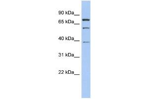 WB Suggested Anti-MOSPD2 Antibody Titration: 0. (MOSPD2 anticorps  (Middle Region))