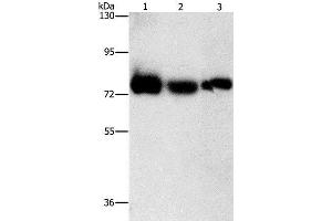 Western Blot analysis of Human fetal muscle tissue, K562 and hela cell using AMPD1 Polyclonal Antibody at dilution of 1:1600 (AMPD1 anticorps)