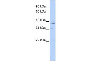 WB Suggested Anti-NR1I3 Antibody Titration:  0. (NR1I3 anticorps  (Middle Region))