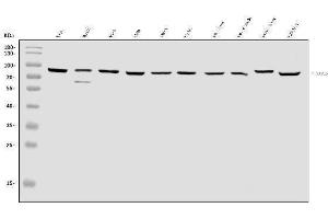 Western blot analysis of SEC23B using anti-SEC23B antibody (ABIN7600429).