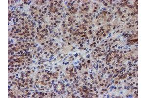 Image no. 7 for anti-ATR Interacting Protein (ATRIP) (AA 42-309) antibody (ABIN1491507)