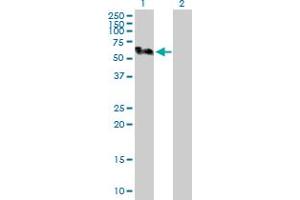 Western Blot analysis of SMU1 expression in transfected 293T cell line by SMU1 MaxPab polyclonal antibody. (SMU1 anticorps  (AA 1-513))