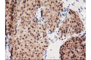 Image no. 7 for anti-UDP-Galactose-4-Epimerase (GALE) antibody (ABIN1498366) (GALE anticorps)