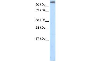 WB Suggested Anti-MKL1 Antibody Titration:  1. (MKL1 anticorps  (C-Term))