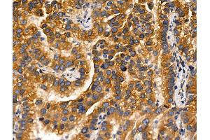 anti-Mitogen-Activated Protein Kinase Kinase Kinase 10 (MAP3K10) (Internal Region) antibody