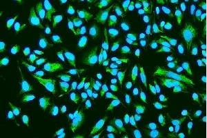 anti-N-Acylsphingosine Amidohydrolase (Acid Ceramidase) 1 (ASAH1) (AA 63-393) antibody