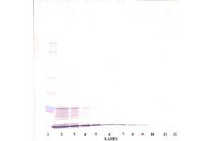 Image no. 2 for anti-Interleukin 15 (IL15) antibody (ABIN464931) (IL-15 anticorps)
