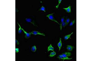 Immunofluorescent analysis of Hela cells using ABIN7156895 at dilution of 1:100 and Alexa Fluor 488-congugated AffiniPure Goat Anti-Rabbit IgG(H+L) (IL-33 anticorps  (AA 123-276))