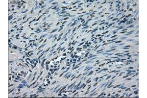 Image no. 5 for anti-NIMA (Never in Mitosis Gene A)-Related Kinase 6 (NEK6) antibody (ABIN1499686)