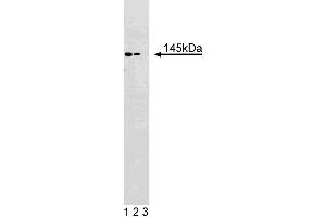 Western blot analysis of eps15 on a Jurkat lysate. (EPS15 anticorps  (AA 694-888))
