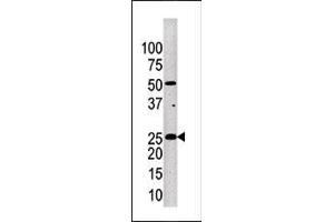 Western blot analysis of anti-KLK4 Pab (ABIN390304 and ABIN2840739) in mouse brain tissue lysate.