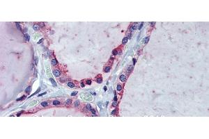 Immunohistochemistry with Human Thyroid lysate tissue at an antibody concentration of 5.