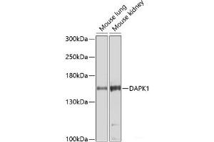 Western blot analysis of extracts of various cell lines using DAPK1 Polyclonal Antibody at dilution of 1:1000. (DAP Kinase 1 anticorps)