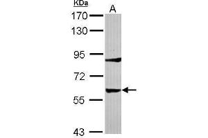 WB Image Sample (30 ug of whole cell lysate) A: IMR32 7. (Tyrosine Hydroxylase anticorps)