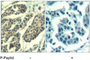 Image no. 1 for anti-Cyclin B1 (CCNB1) (pSer147) antibody (ABIN401595) (Cyclin B1 anticorps  (pSer147))