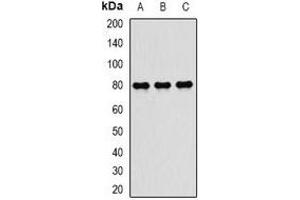 Western blot analysis of TAP2 expression in MCF7 (A), mouse spleen (B), mouse lung (C) whole cell lysates.