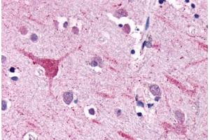 Anti-NPFFR2 antibody  ABIN1049116 IHC staining of human brain, neurons and glia. (NPFFR2 anticorps  (Extracellular Domain))