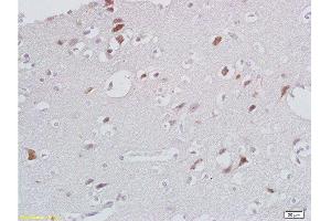 Formalin-fixed and paraffin embedded human brain labeled with Anti- CXCL13/BCA1 Polyclonal Antibody, Unconjugated  at 1:200 followed by conjugation to the secondary antibody and DAB