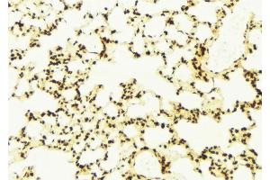 anti-ElaC Homolog 2 (ELAC2) (N-Term) antibody