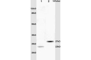 Lane 1: rat brain lysates Lane 2: human colon carcinoma lysates probed with Anti CPSF4/CPSF30 Polyclonal Antibody, Unconjugated (ABIN1386751) at 1:200 in 4 °C. (CPSF4 anticorps  (AA 81-180))