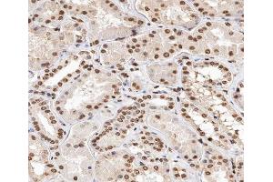 ABIN6267347 at 1/200 staining human kidney tissue sections by IHC-P. (Histone H2A anticorps  (pThr121))